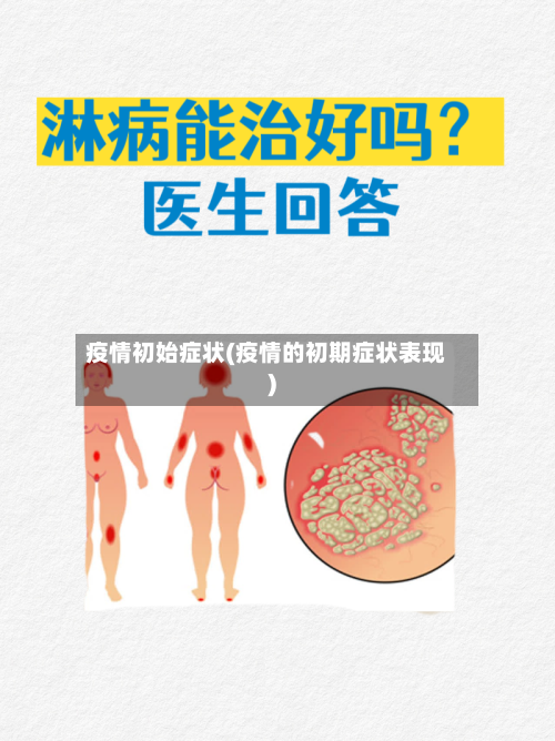 疫情初始症状(疫情的初期症状表现)