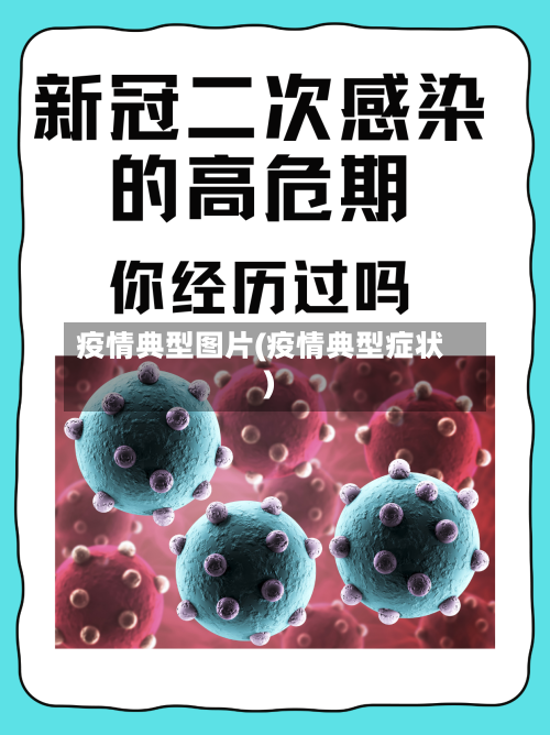 疫情典型图片(疫情典型症状)