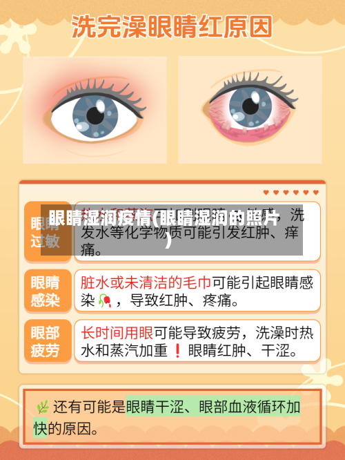 眼睛湿润疫情(眼睛湿润的照片)