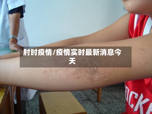肘时疫情/疫情实时最新消息今天