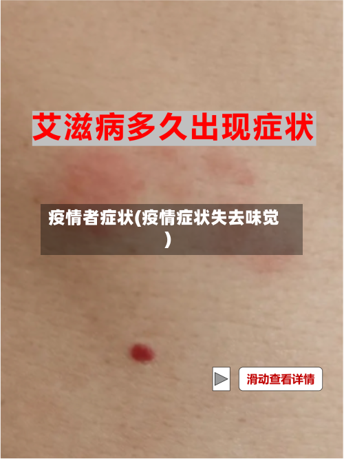 疫情者症状(疫情症状失去味觉)