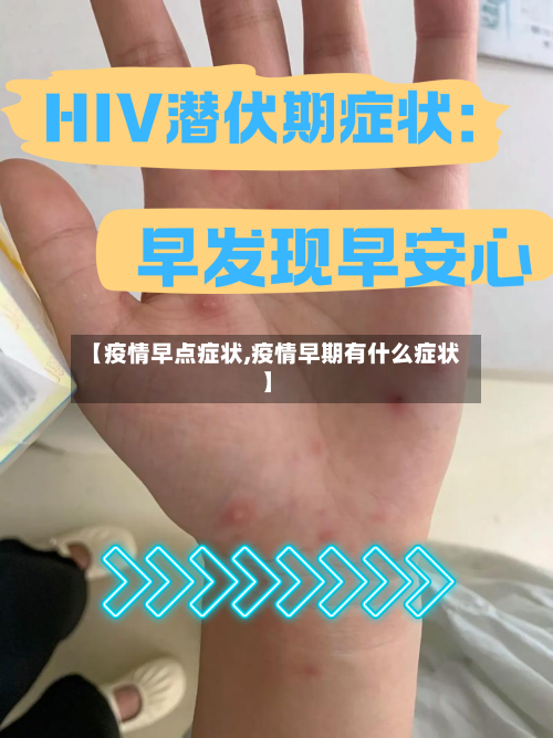 【疫情早点症状,疫情早期有什么症状】-第1张图片