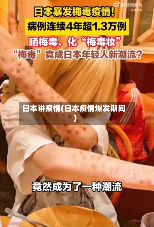 日本讲疫情(日本疫情爆发期间)-第1张图片