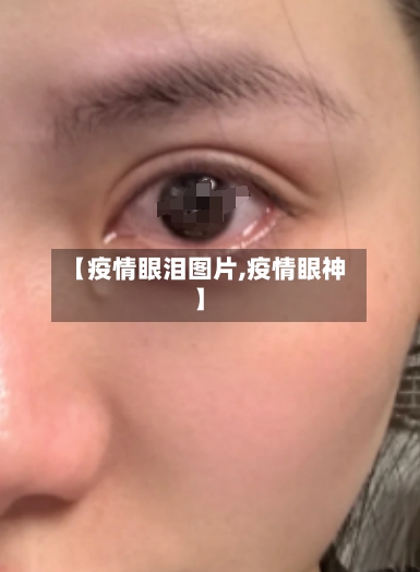 【疫情眼泪图片,疫情眼神】