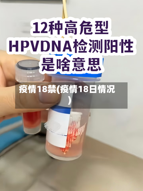 疫情18禁(疫情18日情况)