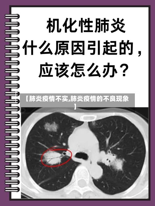 【肺炎疫情不实,肺炎疫情的不良现象】-第1张图片