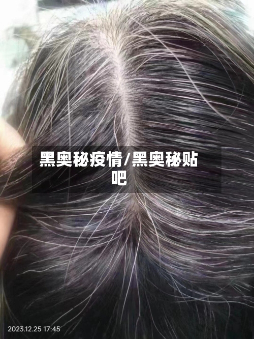 黑奥秘疫情/黑奥秘贴吧-第1张图片