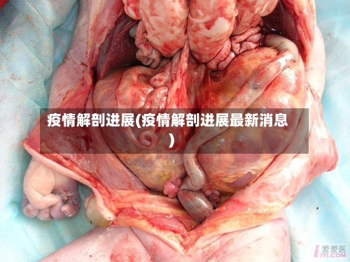 疫情解剖进展(疫情解剖进展最新消息)-第1张图片