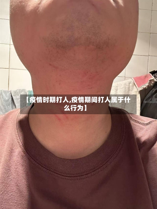 【疫情时期打人,疫情期间打人属于什么行为】
