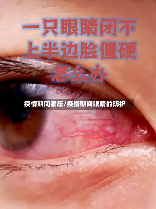 疫情期间眼压/疫情期间眼睛的防护-第1张图片