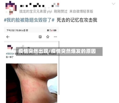疫情突然出现/疫情突然爆发的原因-第1张图片