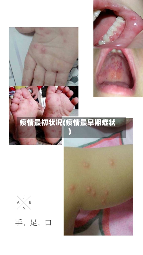 疫情最初状况(疫情最早期症状)