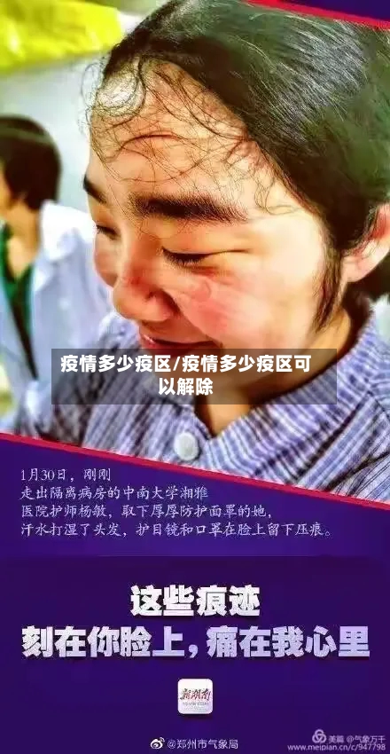 疫情多少疫区/疫情多少疫区可以解除-第2张图片