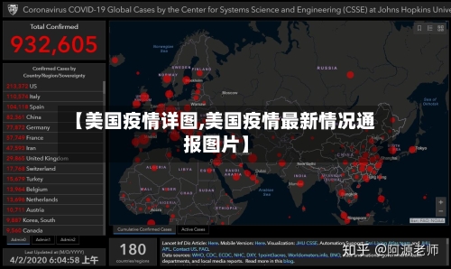 【美国疫情详图,美国疫情最新情况通报图片】