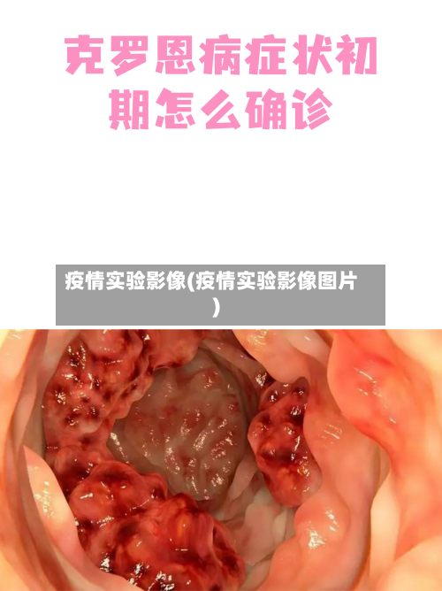 疫情实验影像(疫情实验影像图片)-第1张图片