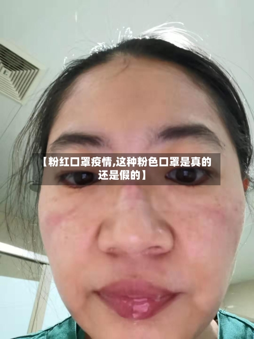 【粉红口罩疫情,这种粉色口罩是真的还是假的】-第2张图片