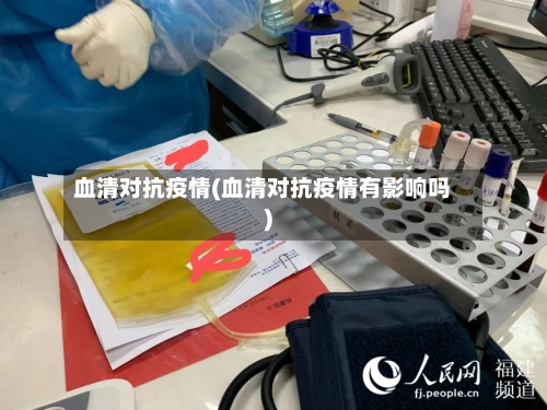 血清对抗疫情(血清对抗疫情有影响吗)-第2张图片