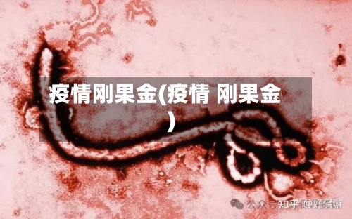 疫情刚果金(疫情 刚果金)-第1张图片