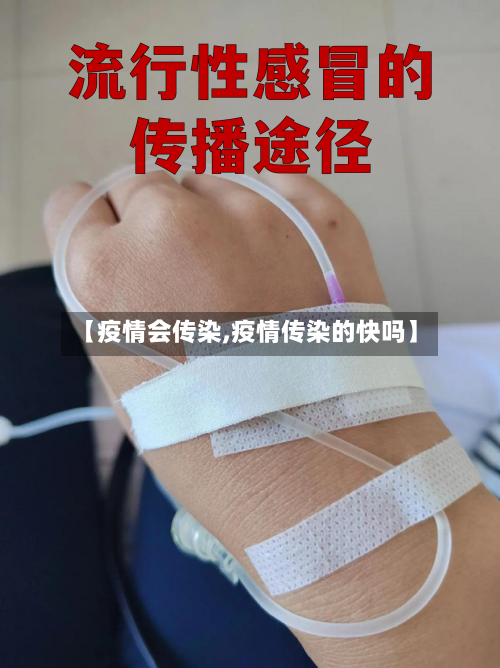 【疫情会传染,疫情传染的快吗】-第2张图片